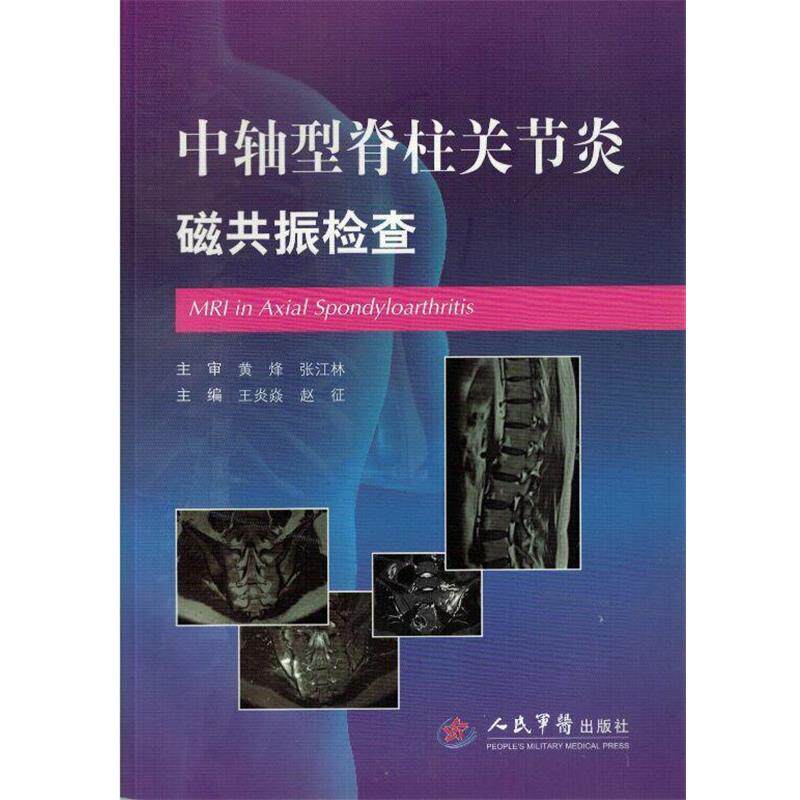 【正版书】 中轴型脊柱关节炎磁共振检查 王炎焱, 赵征, 主编 人民军医出版社