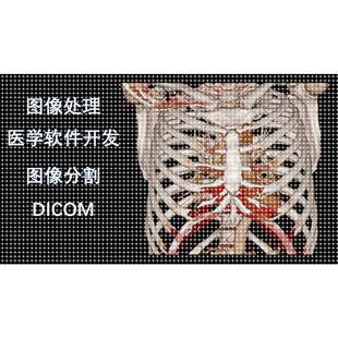 医学图像处理DICOM图像、图像分割、深度学习人工智能、软件开发