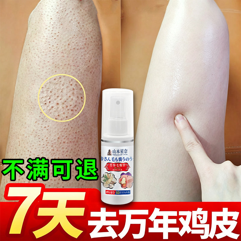 日本鸡皮肤疙瘩毛囊角化药胳膊毛孔粗大堵塞毛囊粉刺痘痘炎专用膏