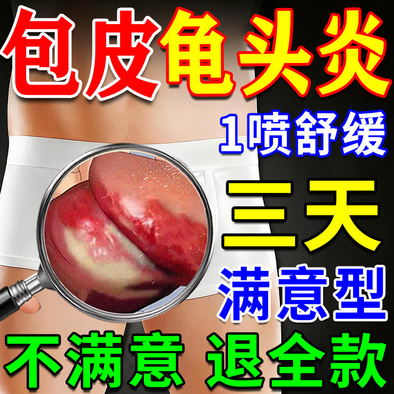 包皮龟头炎真菌感染专外用膏男性士霉菌性白垢珍珠丘疹喷剂正品
