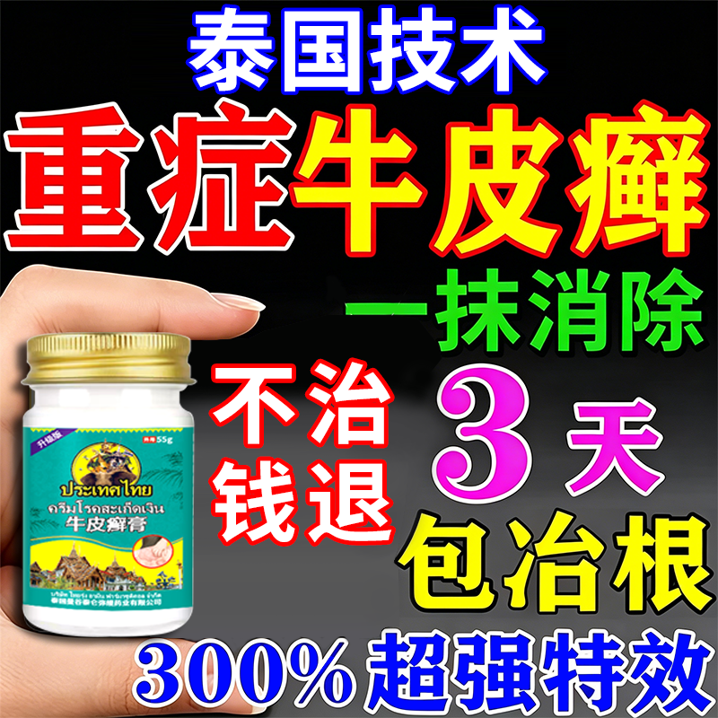 泰国进口牛皮藓银屑病专外用膏药冶疗顽固性皮肤藓杀菌止痒特别效