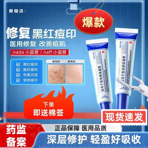 那复达naff小蓝管d淡痘印