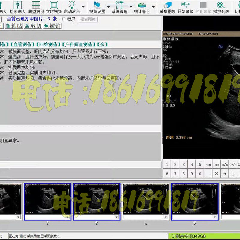 超声工作站软件彩超软件迈瑞彩超软件+标清采集卡+连接线脚踏开关