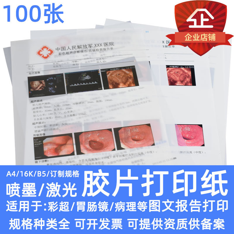 医用胶片彩超打印胶片纸瓷白喷墨激光半透彩色干式胶片双面
