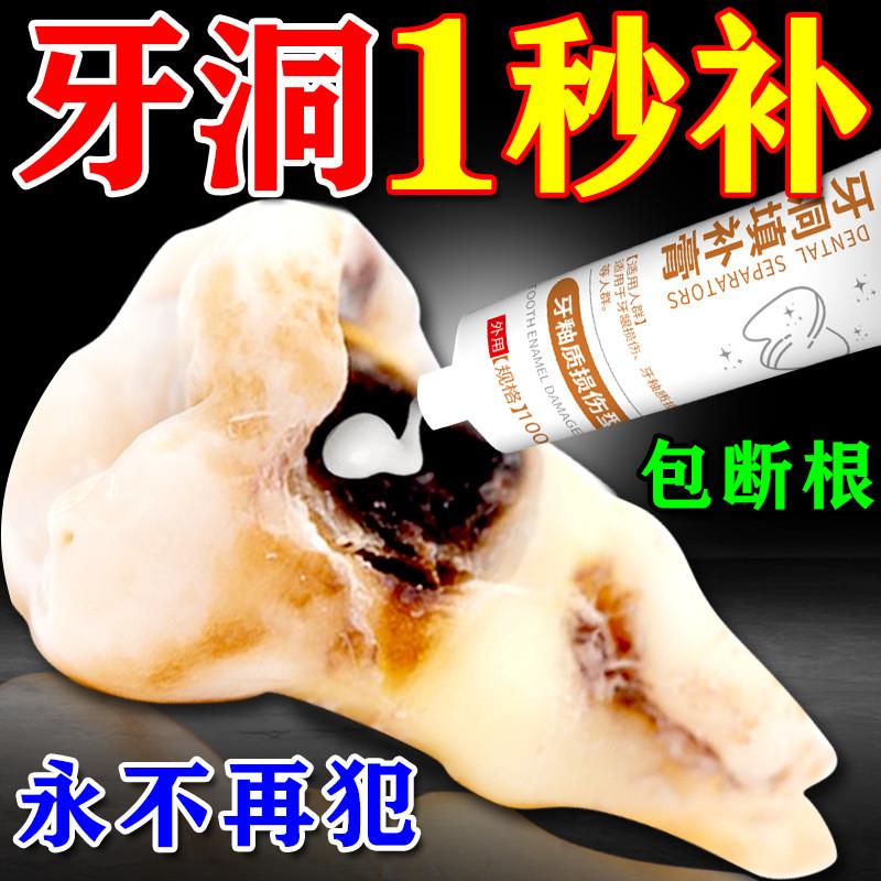 补牙神器自己填充堵牙齿洞膏牙缝自己在家防蛀虫牙洞龋齿修覆牙膏