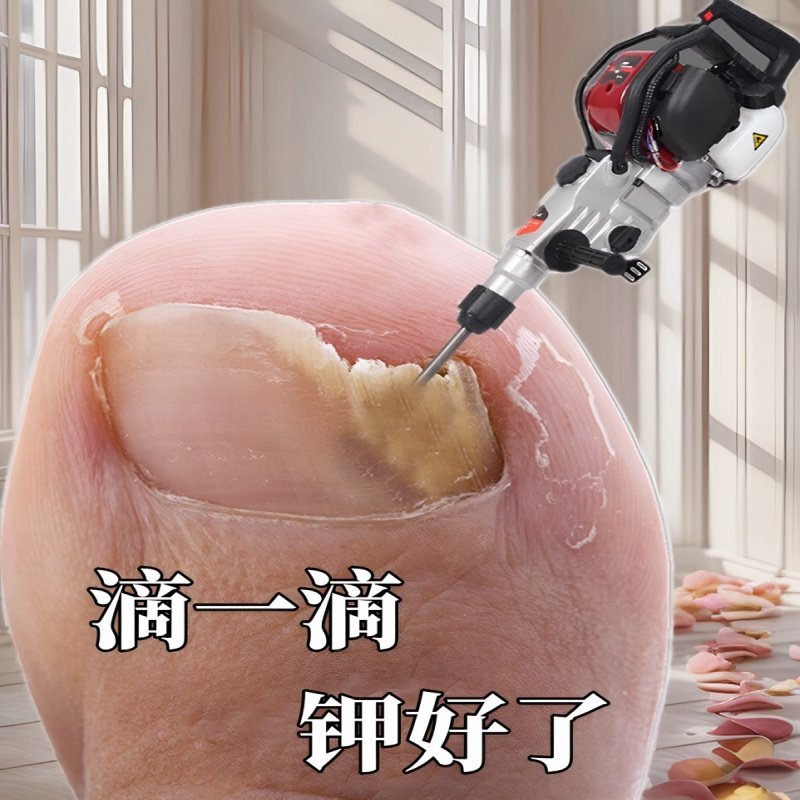 不佣包，无需修【滴一滴】无疼感   手指脚趾の坏钾变好钾