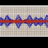 8.2质谱光学电磁场仿真软件 Simion8.0 8.1 离子电子光学仿真模拟