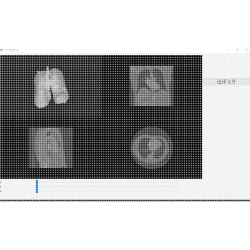 CT三维重建 CT分割 滤波 医学图像的可视化 PyQt 支持JPG PNG TIF