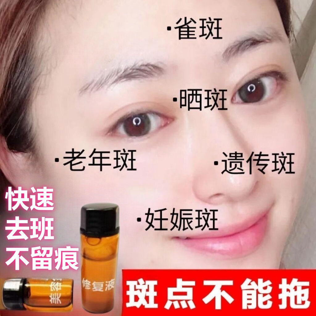 【美容院同款】点斑去班点志祛志黑点药水美容金水修复液不留疤痕