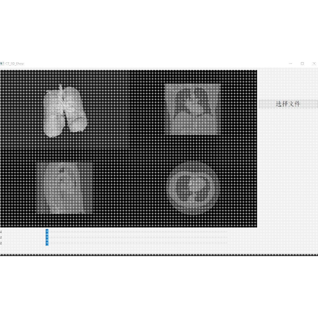 CT三维重建 CT分割 滤波 医学图像的可视化 PyQt 支持JPG PNG TIF