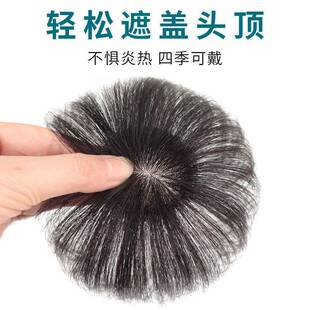 头顶头发稀少发顶假发贴片补发缝填充轻薄少量增发隐形无痕自然补