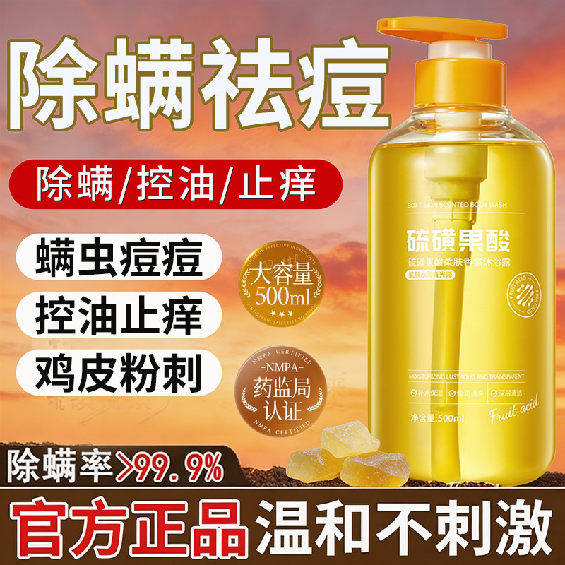 硫磺果酸沐浴露除螨祛痘止痒后背保湿鸡皮持久留香液乳香皂男女士