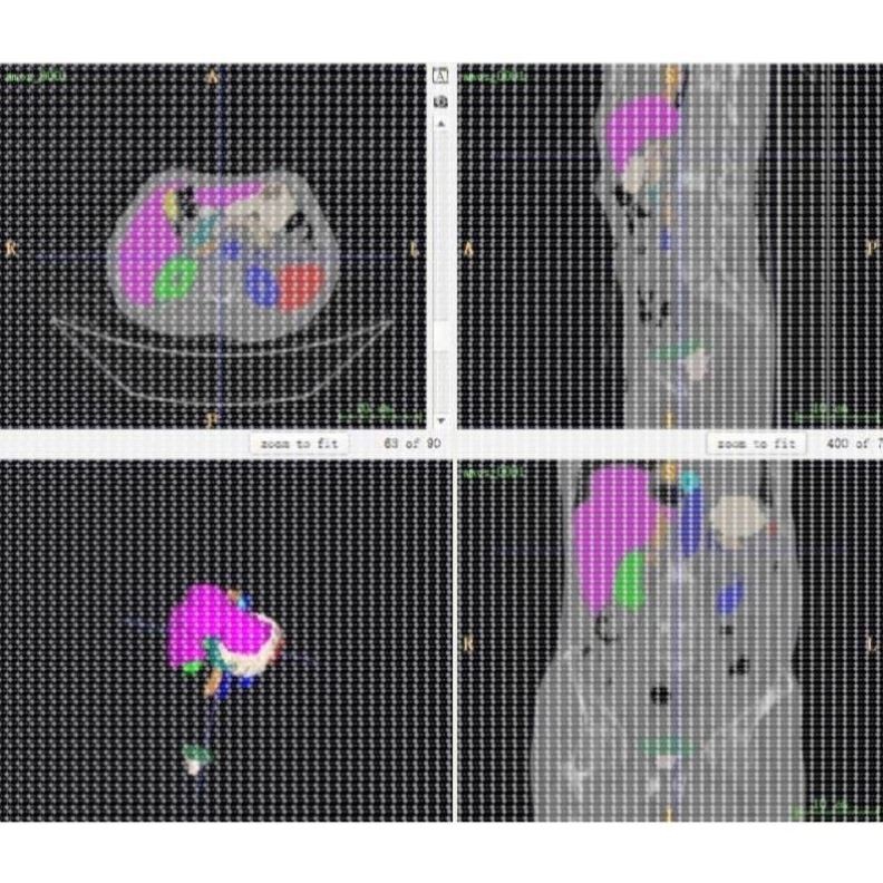 R语言机器学习单细胞多组学空间转录组深度学习基因组学10X差异