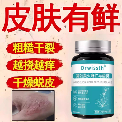 卡菲非安肤素马齿苋片止痒舒缓