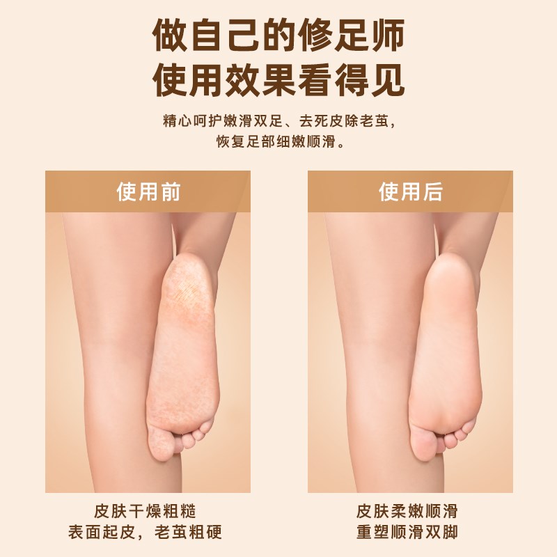 志科电动修脚器充电式自动磨脚皮去脚皮死皮刀老茧磨脚神器修足机