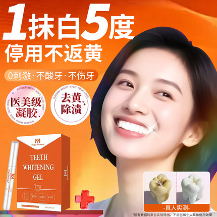 牙齿美白凝胶笔速效去黄一洗白除牙烟渍茶渍美牙齿变白神器