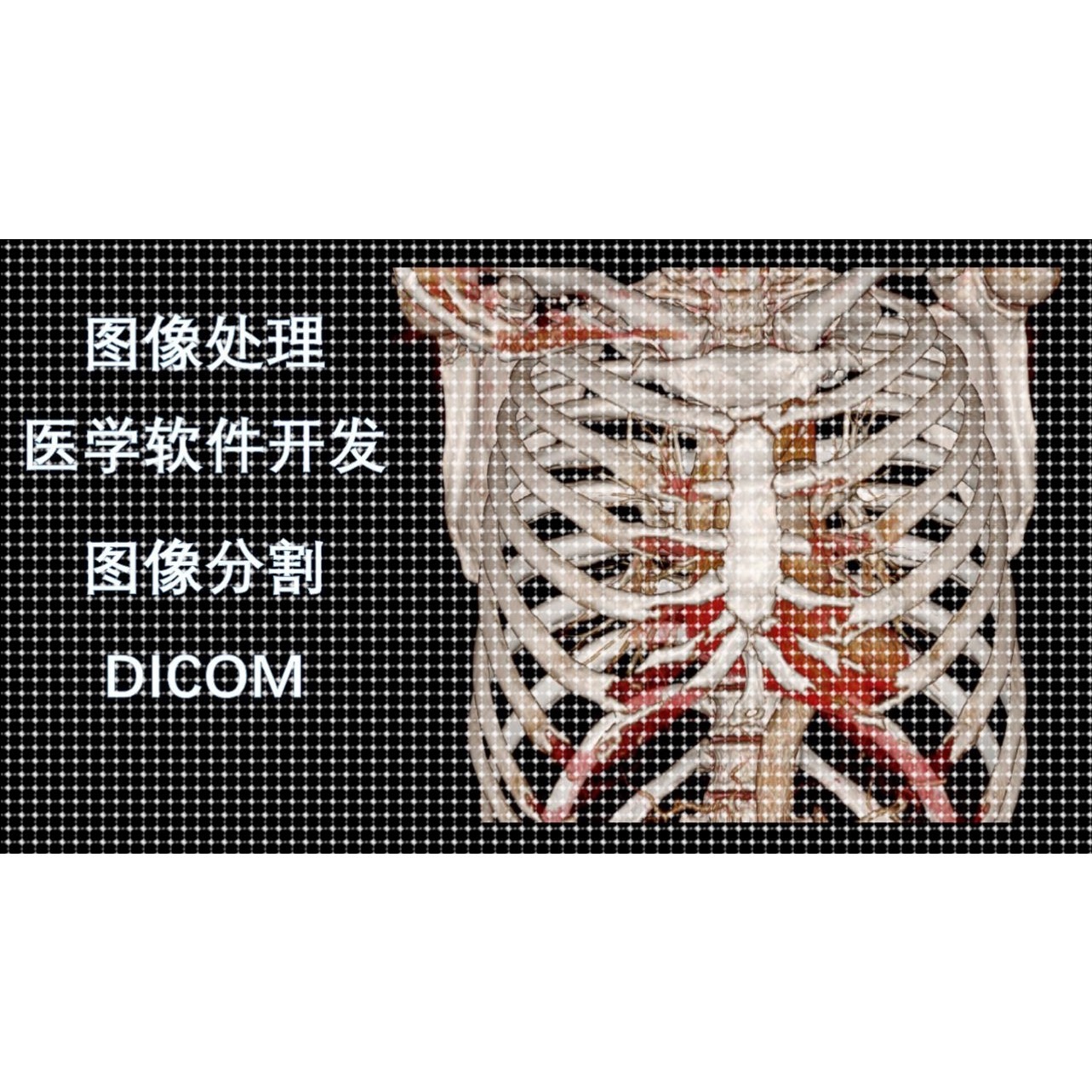 医学图像处理DICOM图像、图像分割、深度学习人工智能、软件开发图片