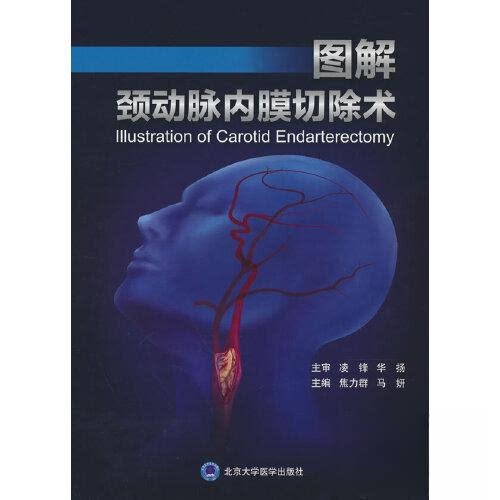 【正版书籍】图解颈动脉内膜切除术焦力群马妍北京大学医学出版社
