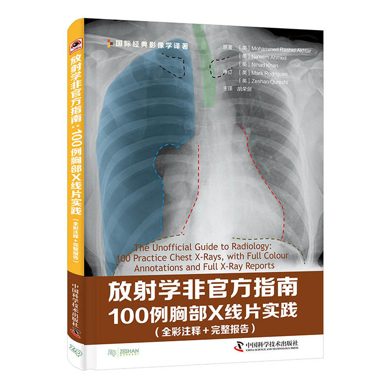 【正版书籍】放学非官方指南100例胸部X线片实践默罕默德拉希德阿克塔奈姆艾哈迈德尼哈德汗著中国科学技术出版社