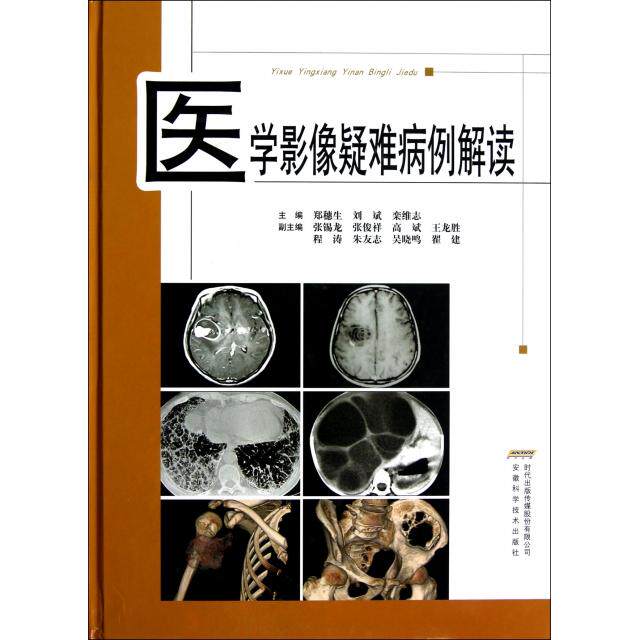 【正版书籍】医学影像疑难病例解读郑穗生刘斌栾维志安徽科学技术出版社