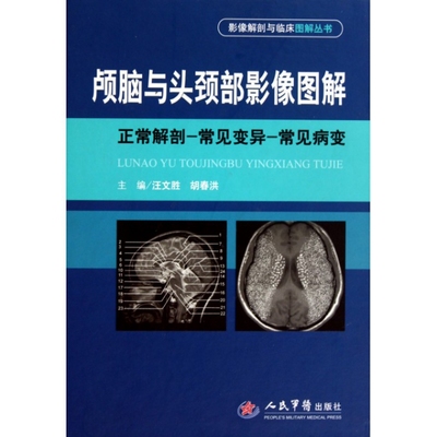 正版新书 颅脑与头颈部影像图解(正常解剖常见变异常见病变)(精)/影像解剖与临床图解丛书 汪文胜//胡春洪 人民军医