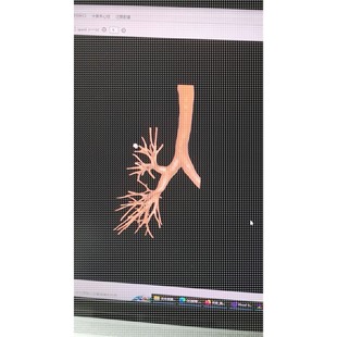 影像組學 醫(yī)學圖像分割 體積測量 表面積測量 三維重建
