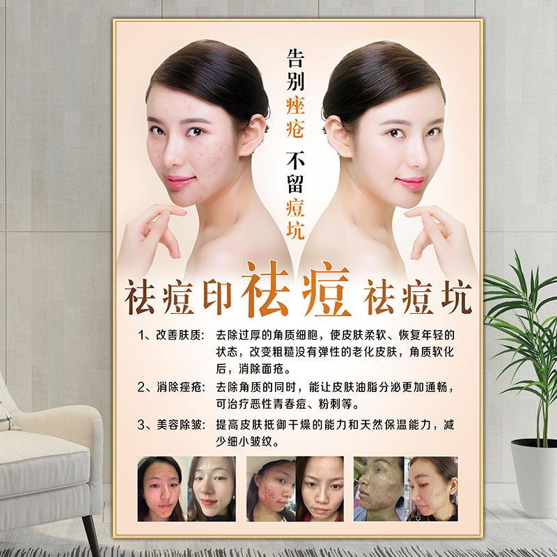 祛斑海报祛痘宣传画斑痘敏广告祛痘印痘坑色斑图片美容院挂画kt板