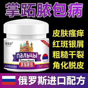 掌趾脓疱病症专用药膏掌跖角化症手脚红斑干裂蜕皮角症掌跖脓包病