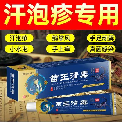 鑫辰盛苗王清毒手上起小水泡手痒手脱皮汗疱疹止痒膏