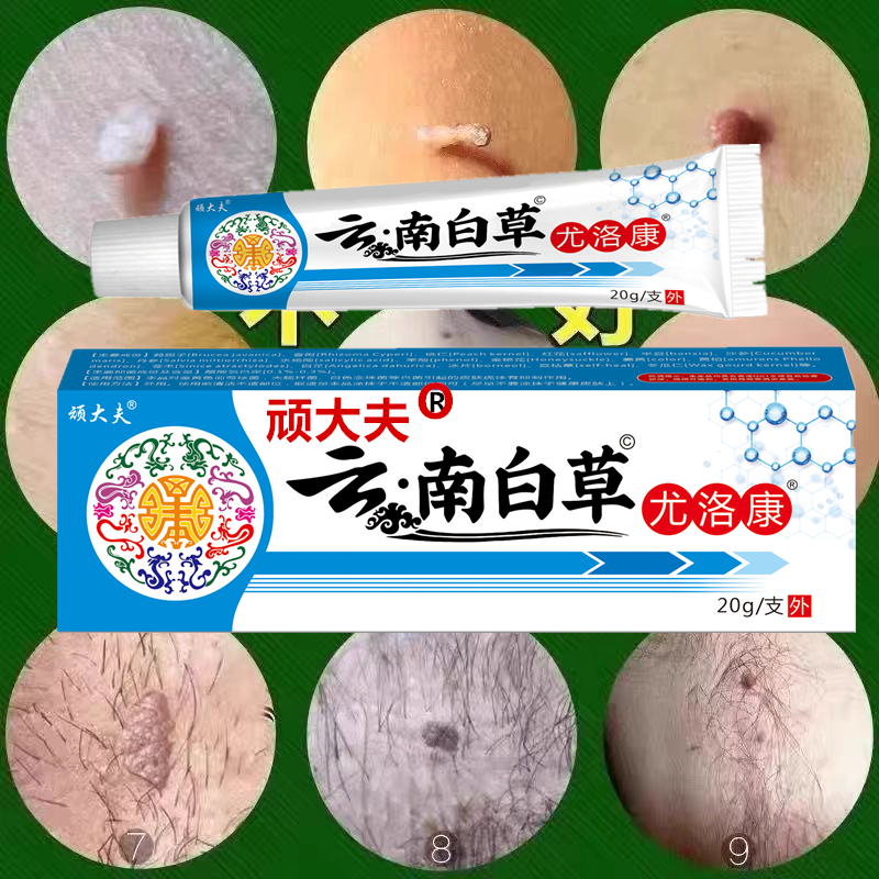 顽大夫正品云南白草克膏脖子手足腋下丝状扁平肉刺【小肉粒专用】
