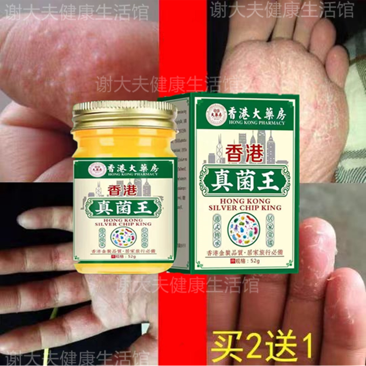 香港真菌王止痒膏湿皮炎手足真菌感染脚丫水泡官方正品旗舰店