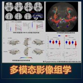 多模态脑影像数据分析处理组学脑功能DTI磁共振成像fmri技术培训