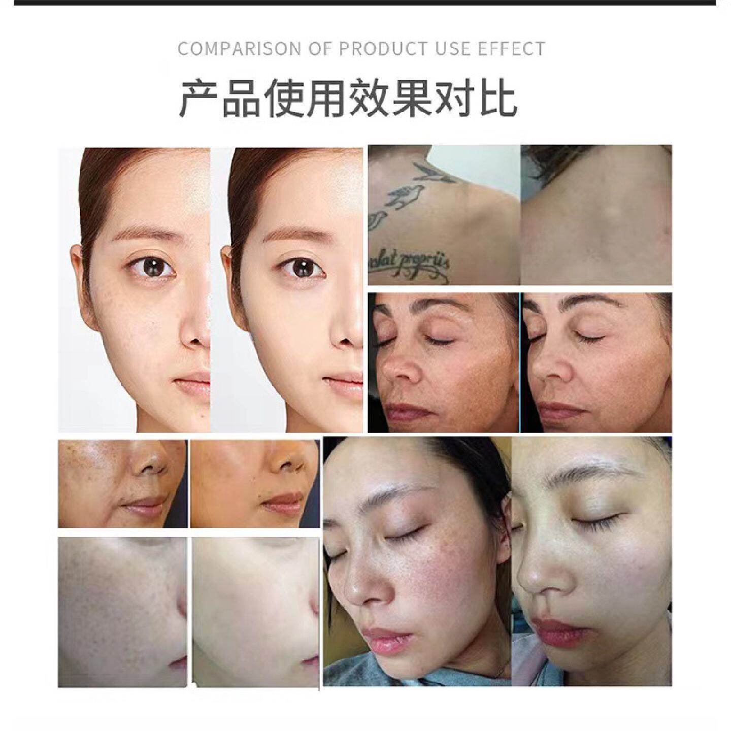 新款便携式黑科技无创洗眉机洗纹身点痣祛斑台式小皮秒美容院仪器