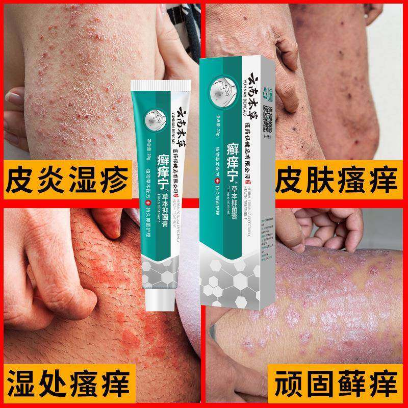 隆力奇蛇胆清凉草本止痒凝露跳蚤咬止痒膏背上红痒植物膏皮肤全身