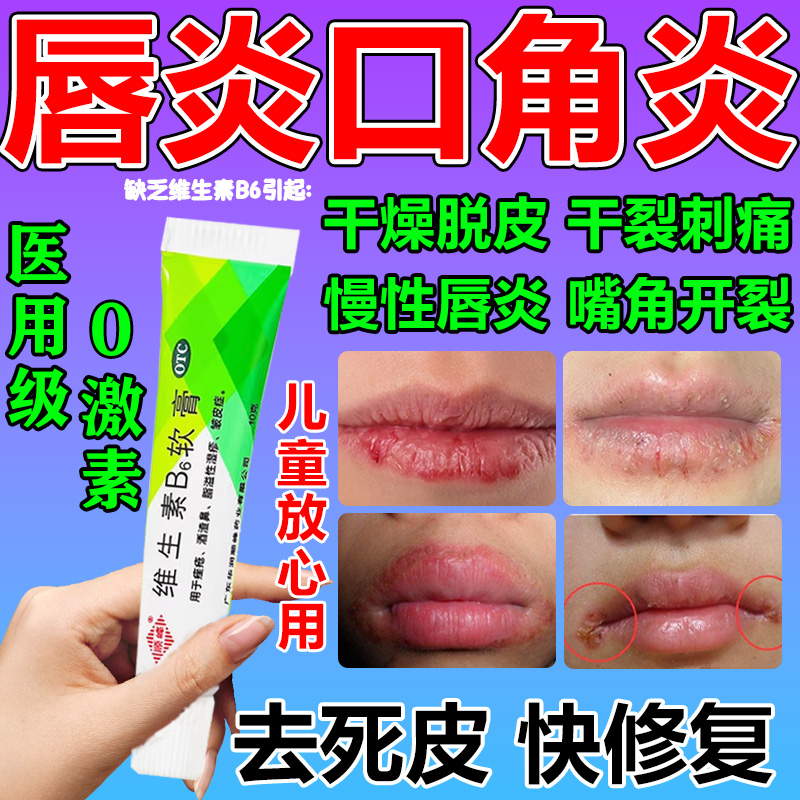 【顺峰】维生素B6软膏1.2%*10g*1支/盒