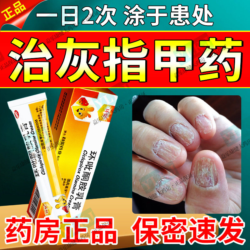 国药正品灰指甲专用药膏手脚趾指甲真菌感染甲板变黄增厚变脆空甲