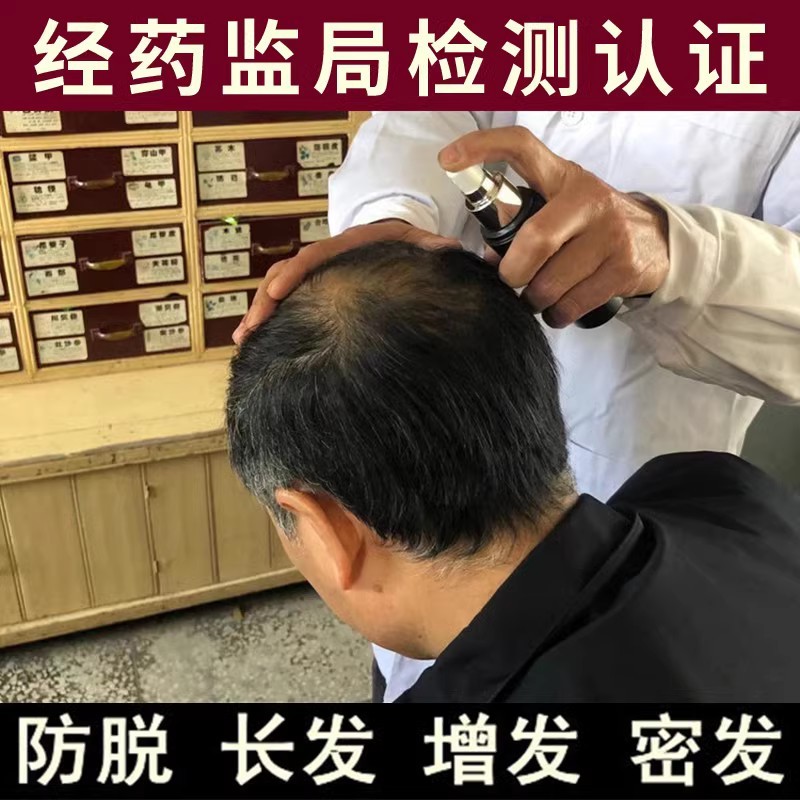 生发增发密发液快速防脱发头发增长液育发液长发剂生发液男女浓密