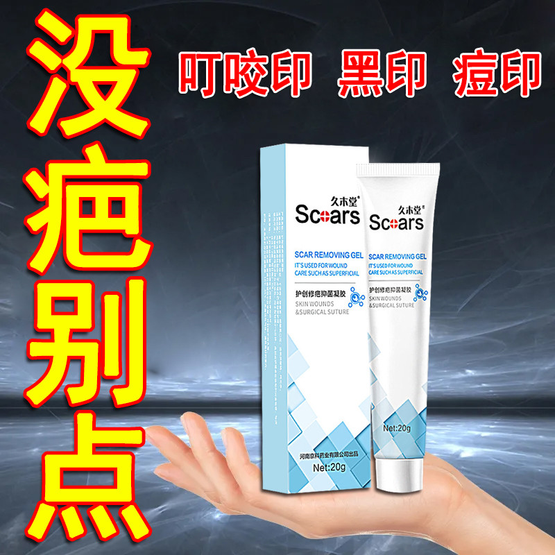 腿上挠印痘印烫伤疤痕蚊虫叮咬去黑印淡化黑色素沉淀儿童成人专用