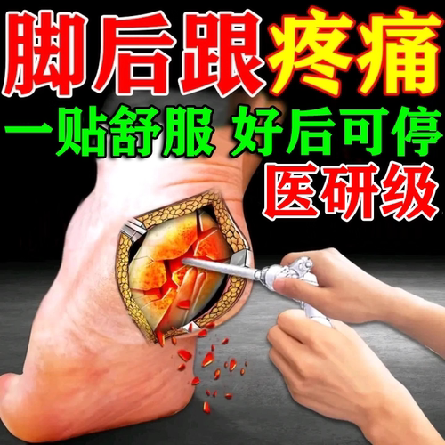 足跟痛贴筋膜炎骨刺脚后跟疼