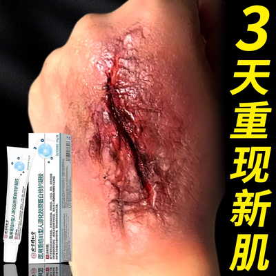 皮肤科也在用的医用生长因子凝胶