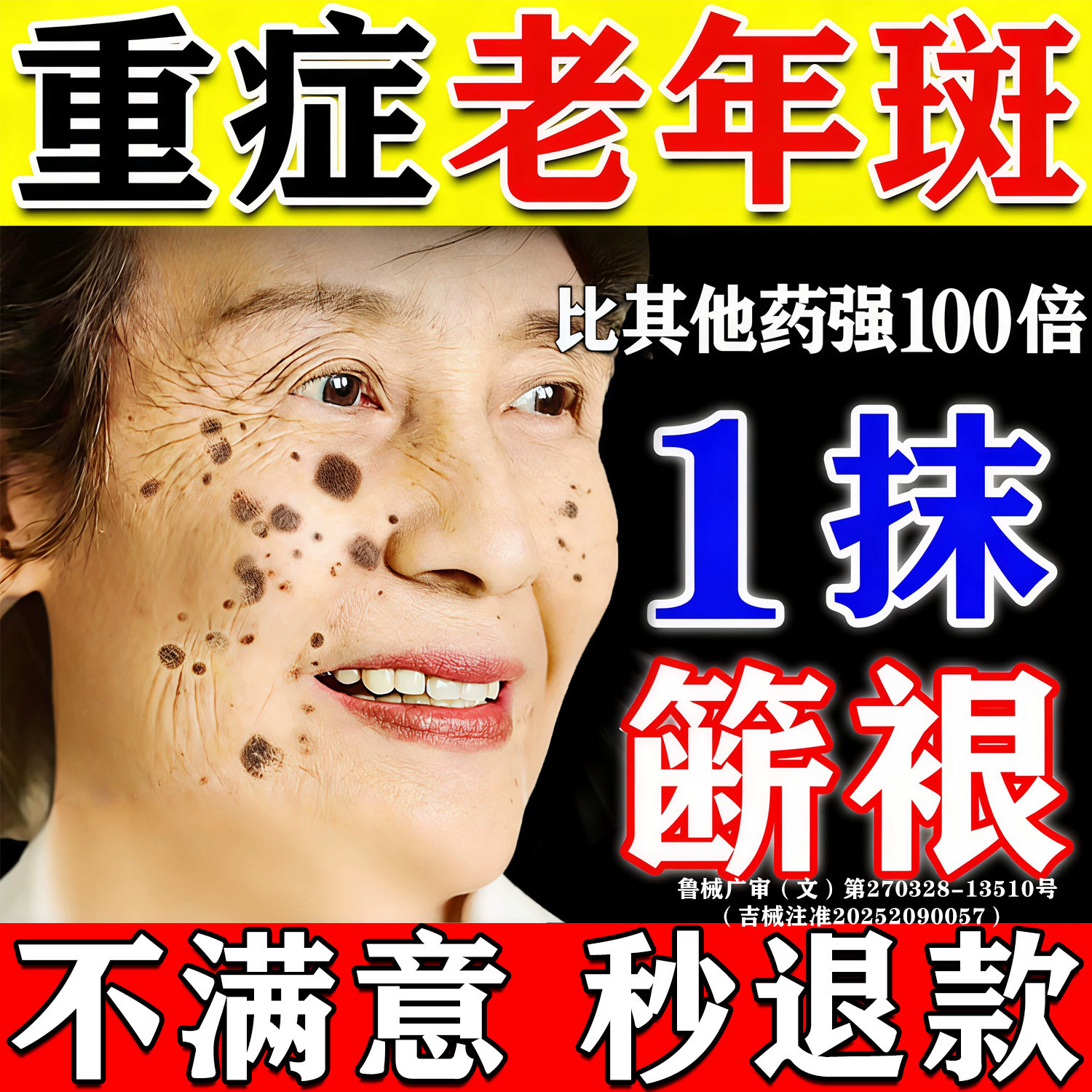 【500%包祛斑】一抹祛斑无效秒退