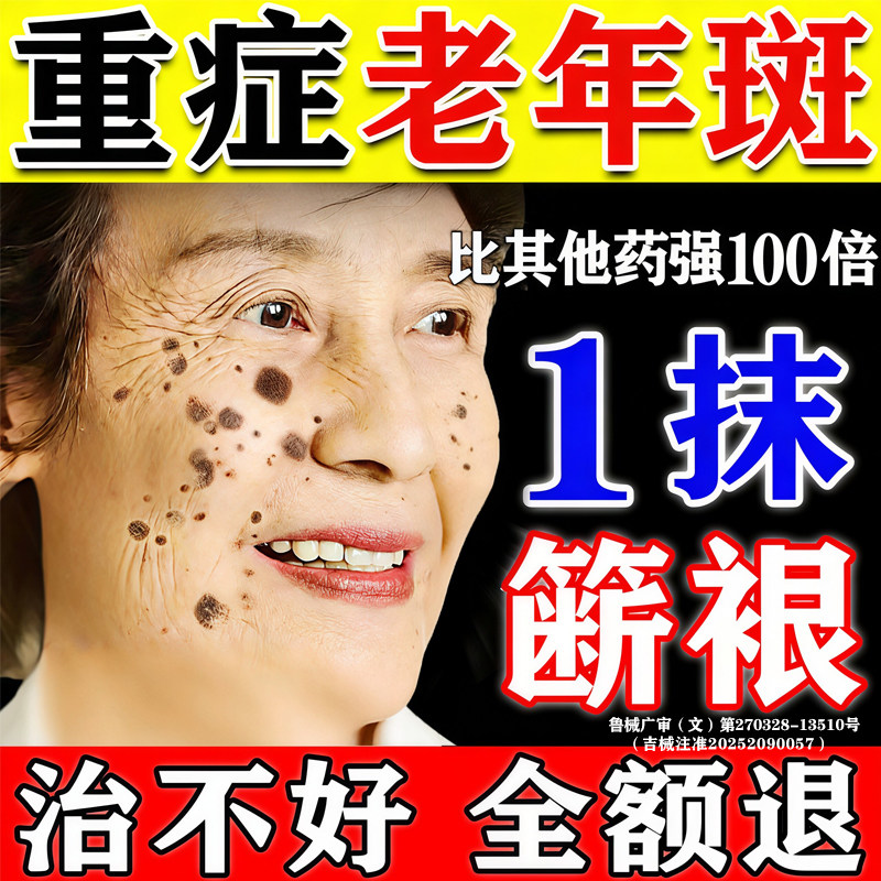 【500%包祛斑】一抹祛斑无效秒退