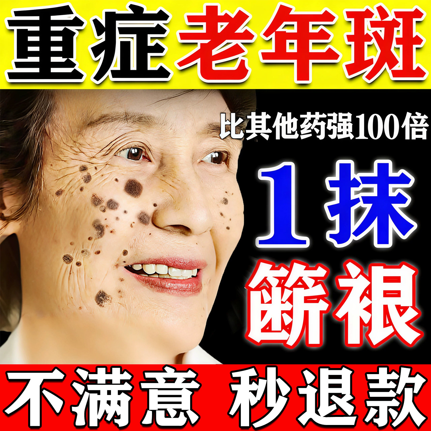 【500%包祛斑】一抹祛斑无效秒退