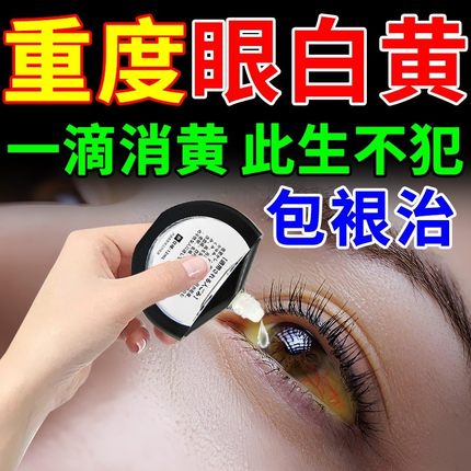 眼白发黄修复眼睛清澈滴眼液去黄去红血丝混浊眼底黄斑病变眼水