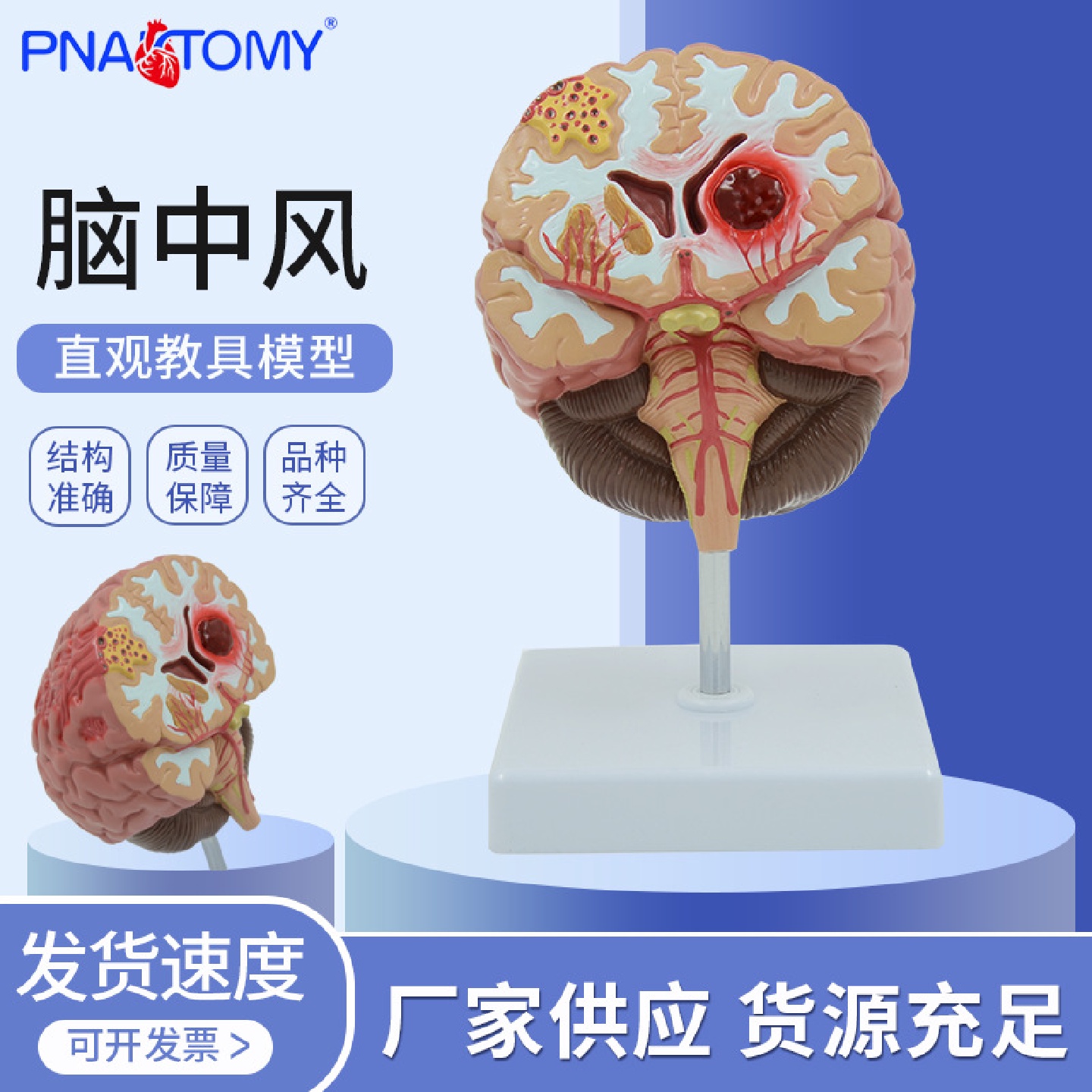 人体脑解剖模型脑出血动脉大脑动静脉畸形脑病理大脑教具