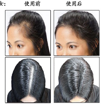 Dexe黑浓增发纤维假发美发粉浓密发宝补发男女头发快速密发多稀发