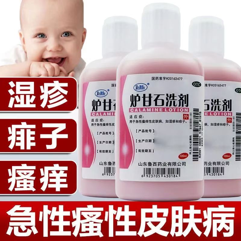 湿疹瘙痒痱子红肿 急性皮肤过敏止痒 收敛 瑞林炉甘石洗剂100ml