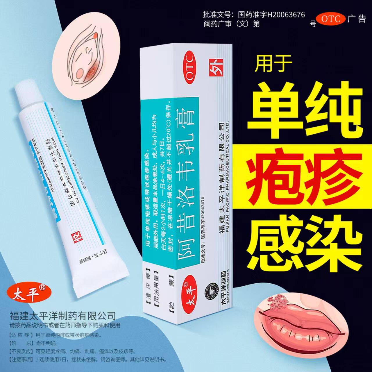抗病毒 单纯疱疹感染 带状疱疹皮肤疱疹 太平阿昔洛韦乳膏10g