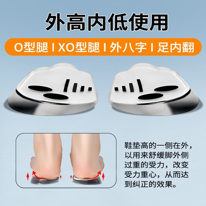 升级xo型腿成人矫正鞋垫小腿外翻o形腿x型腿型直腿神器儿童足内翻