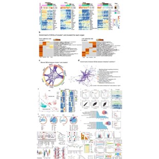 质谱数据分析 高分辨率数据分析 代谢组学 蛋白组学  LCMS GCMS